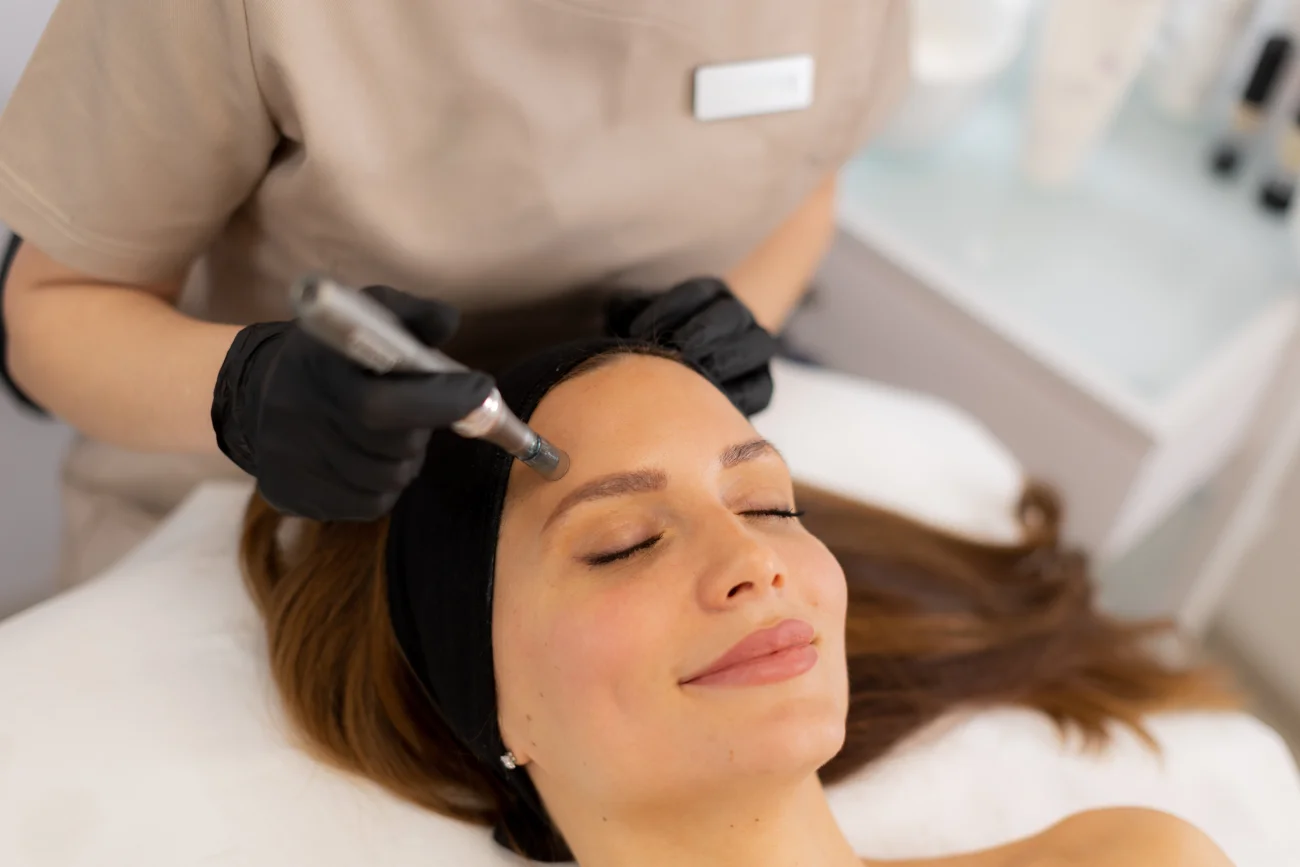 Nano Needling & Peeling Esthétique
